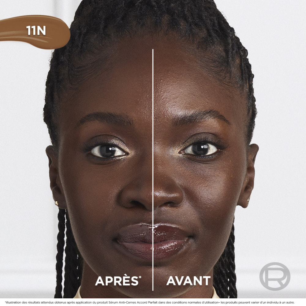 L'Oréal Paris Sérum Anti-Cernes Accord Parfait 11N 11ml