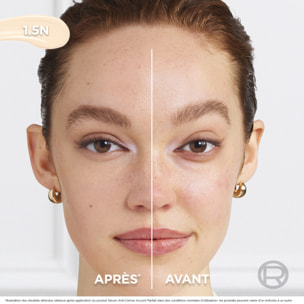 L'Oréal Paris Sérum Anti-Cernes Accord Parfait 1.5N 11ml