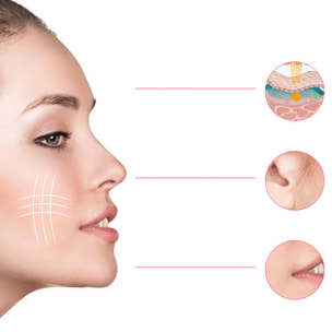 Dispositivo EMS de electroestimulación facial. Efecto reafirmante, remodelador, suavizar signos edad.