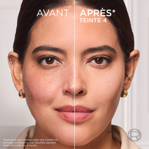 L'Oréal Paris Accord Parfait - Baume Teinté - Light Medium