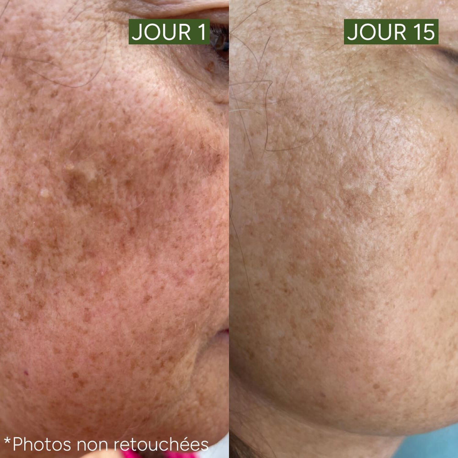 [Active-Lift] - Le Sérum Unifiant Anti-Taches 30 ml