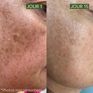 [Active-Lift] - Le Sérum Unifiant Anti-Taches 30 ml