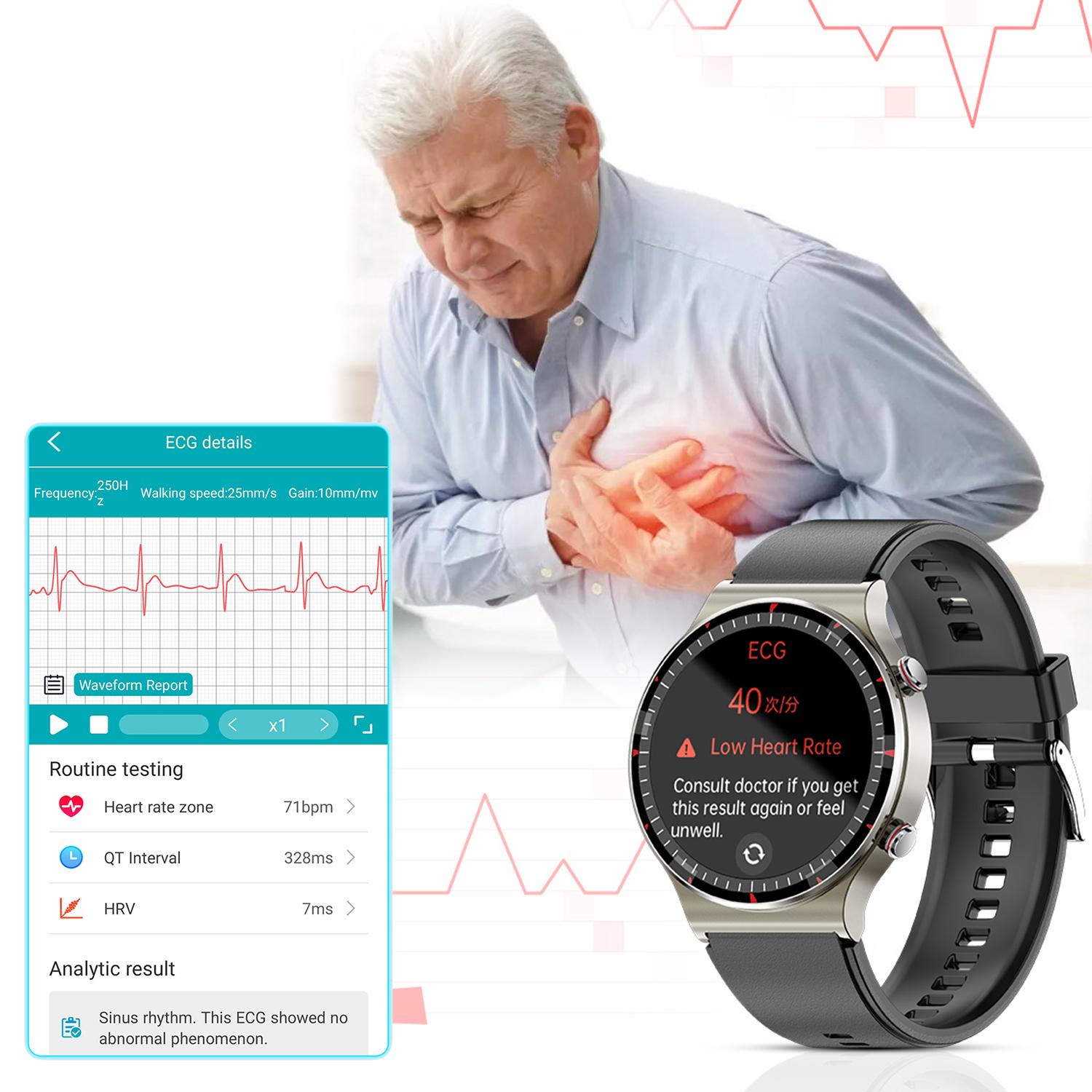 Smartwatch G08 con ECG de grado médico. Monitor de O2 en sangre, apnea del sueño. 10 modos deportivos.