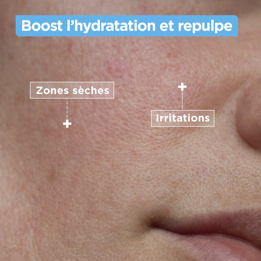 Mixa Nettoyant Confort Anti-sécheresse au Squalane et Acide Hyaluronique 150 ml