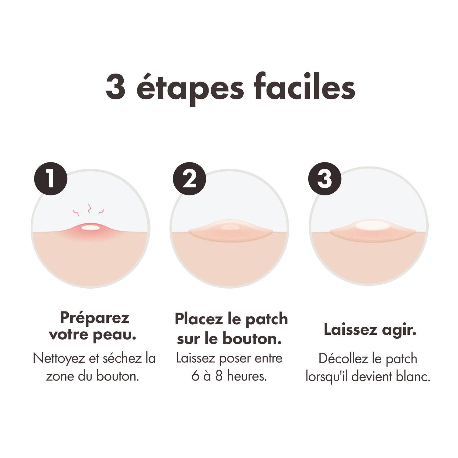 HERO Mighty Patch - Patchs Anti-Acné Invisible+ 39 Patchs