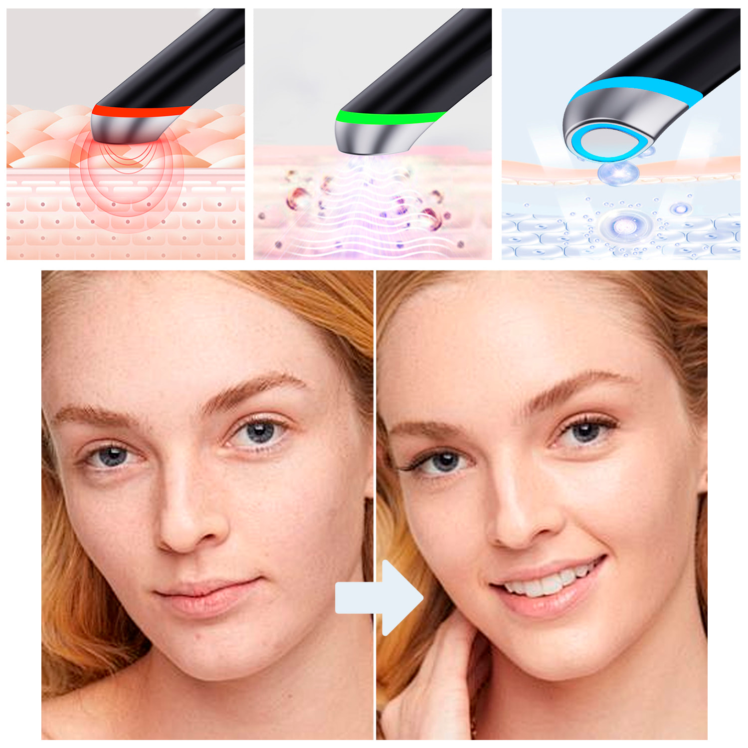 Instrumento de belleza 4 en 1 con luces LED, EMS y modo calor.