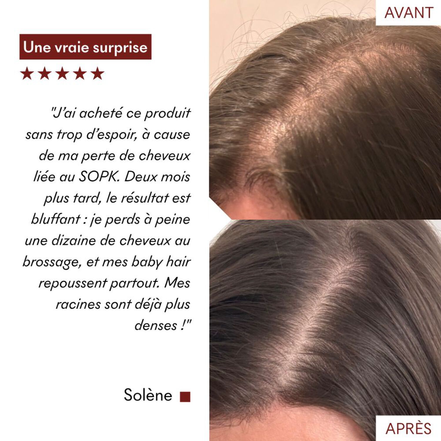 Tricho-Boost - Sérum Chute de Cheveux 20 ml