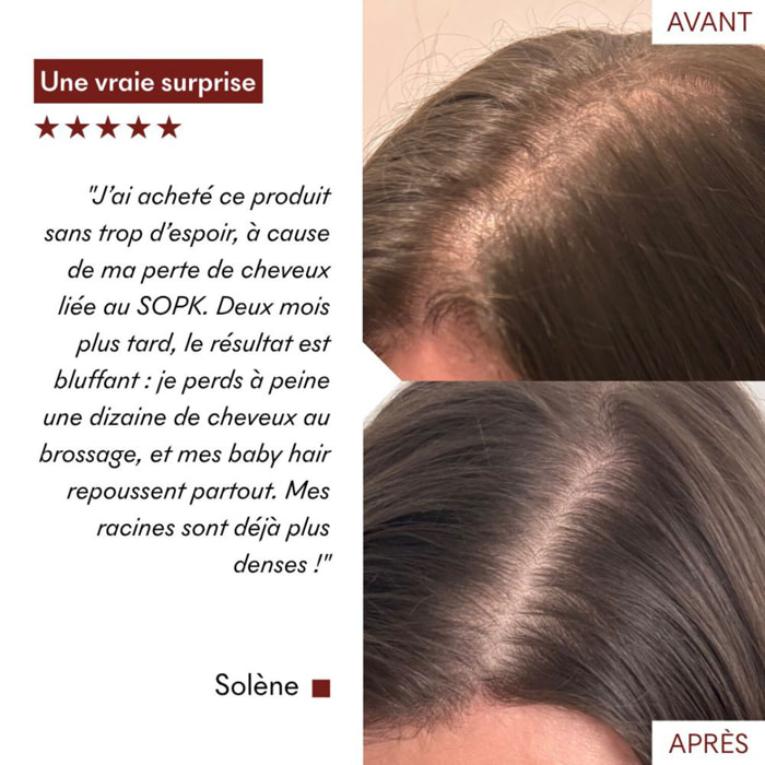 Tricho-Boost - Sérum Chute de Cheveux 20 ml