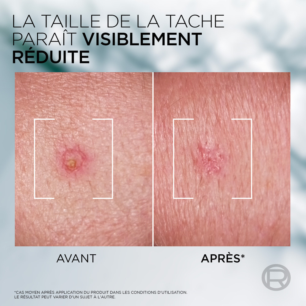 L'Oréal Paris Men Expert Derma Control Pâte S.O.S Anti-Imperfections 45ML