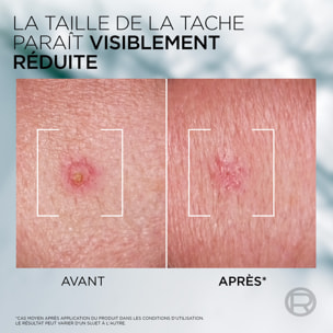 L'Oréal Paris Men Expert Derma Control Pâte S.O.S Anti-Imperfections 45ML