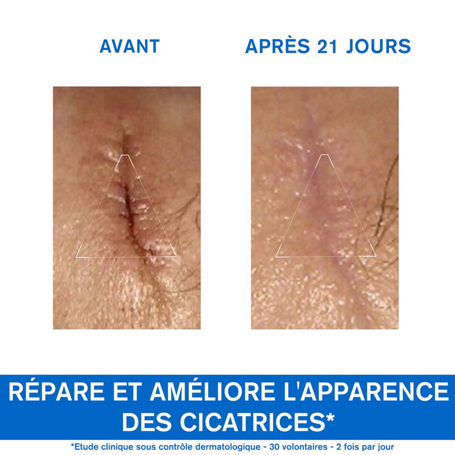 Bariéderm - Cica-Crème - Réparatrice au Cuivre-Zinc