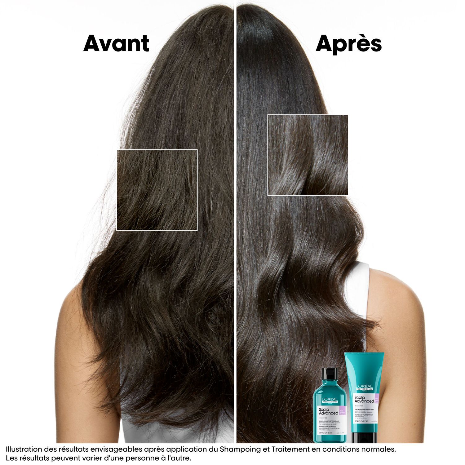 Serie Expert Scalp Advanced - Shampooing Dermo-Regulateur Effet Apaisant - Cuirs Chevelus Sensibles 500 ml