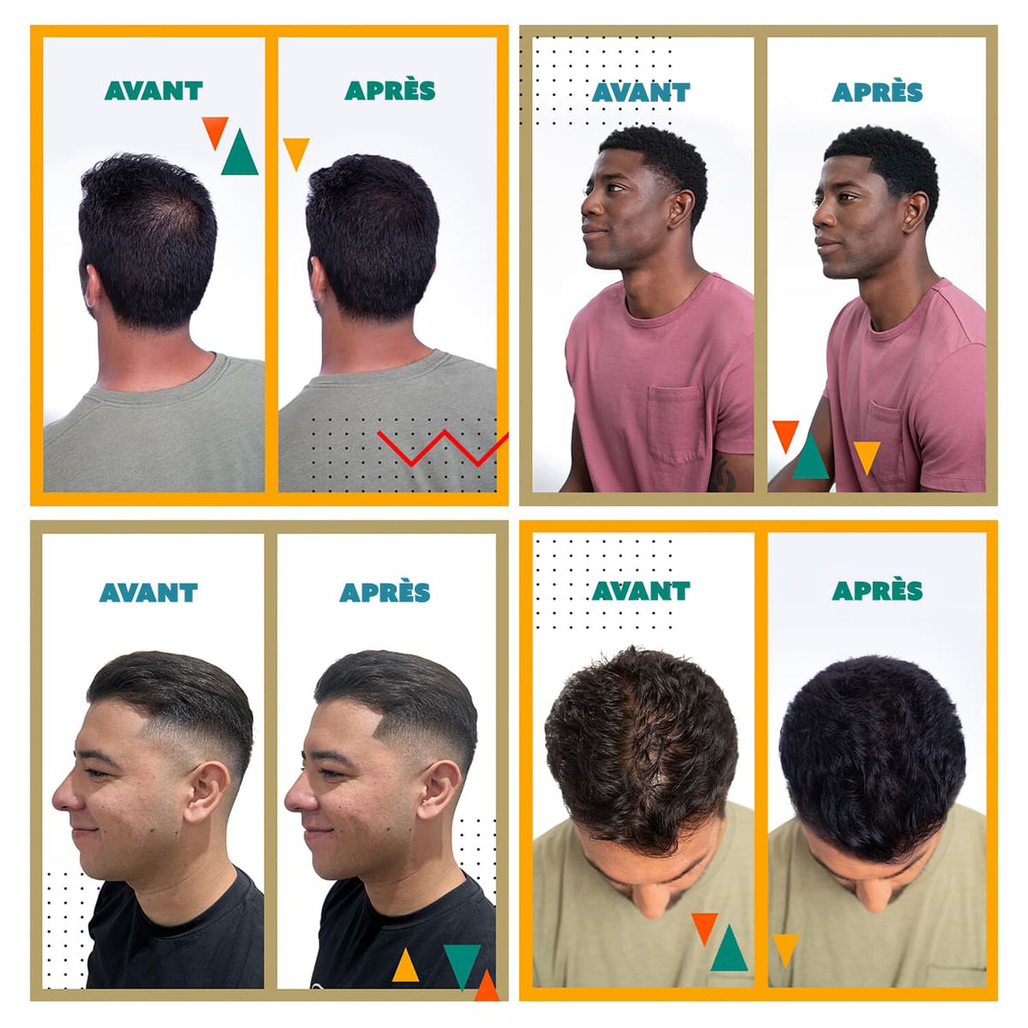 Fibre Capillaire Densifiante - Combles les Zones Clairsemées - Noir