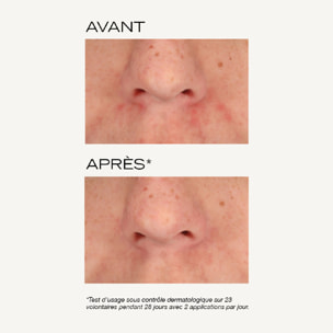 Nue - Masque Peeling Intense 50ml