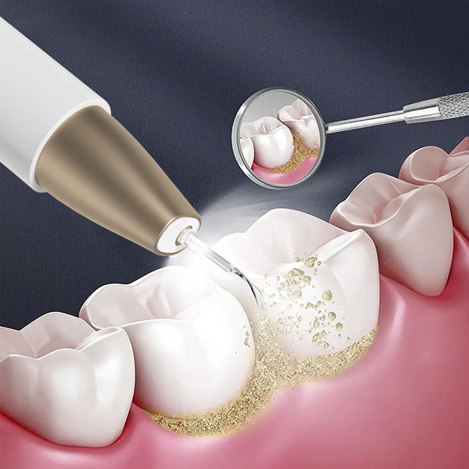 Ablatore dentale ad ultrasuoni. Base di ricarica, 2 testine incluse. 5 intensità.