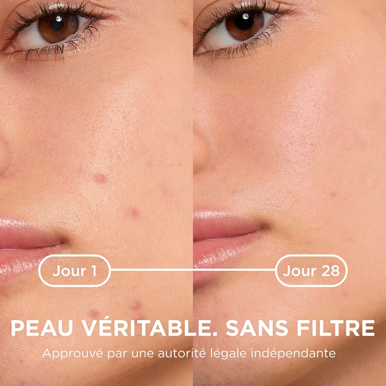 SEBIUM KERATO+ - Gel-Crème Anti-imperfections 30 ml