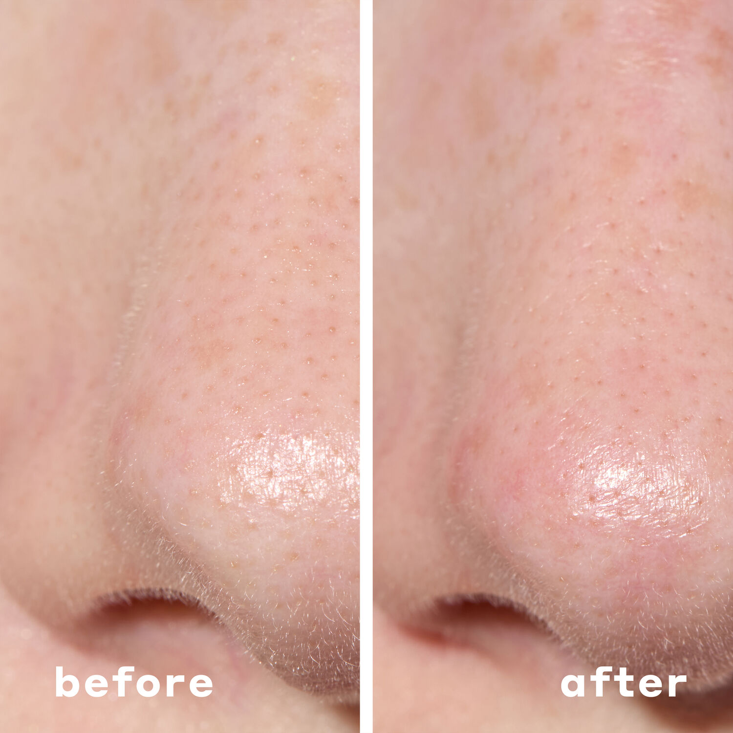 2-In-1 Deep Cleansing Pore Strip - Masque 2 en 1 pour nettoyage en profondeur