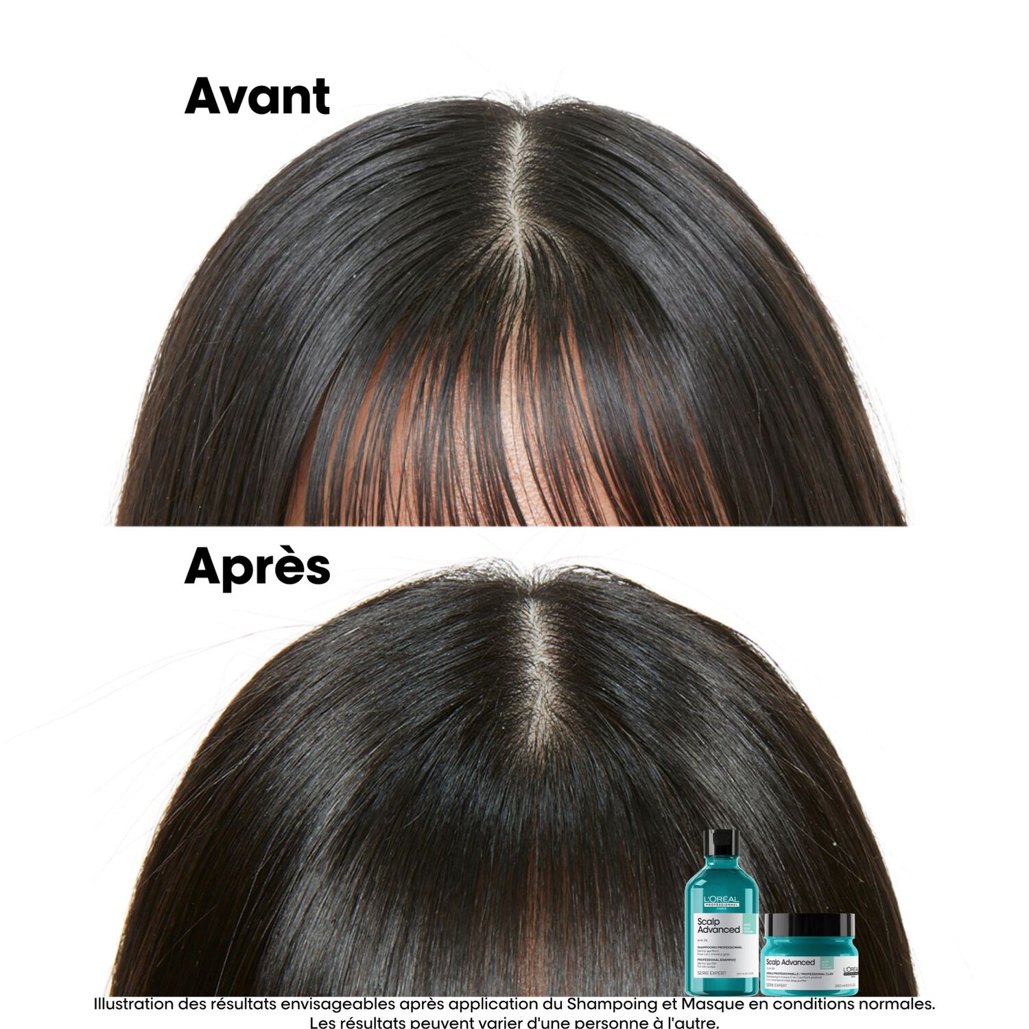 Serie Expert Scalp Advanced - Argile 2-En-1 Purifiante Anti-Gras