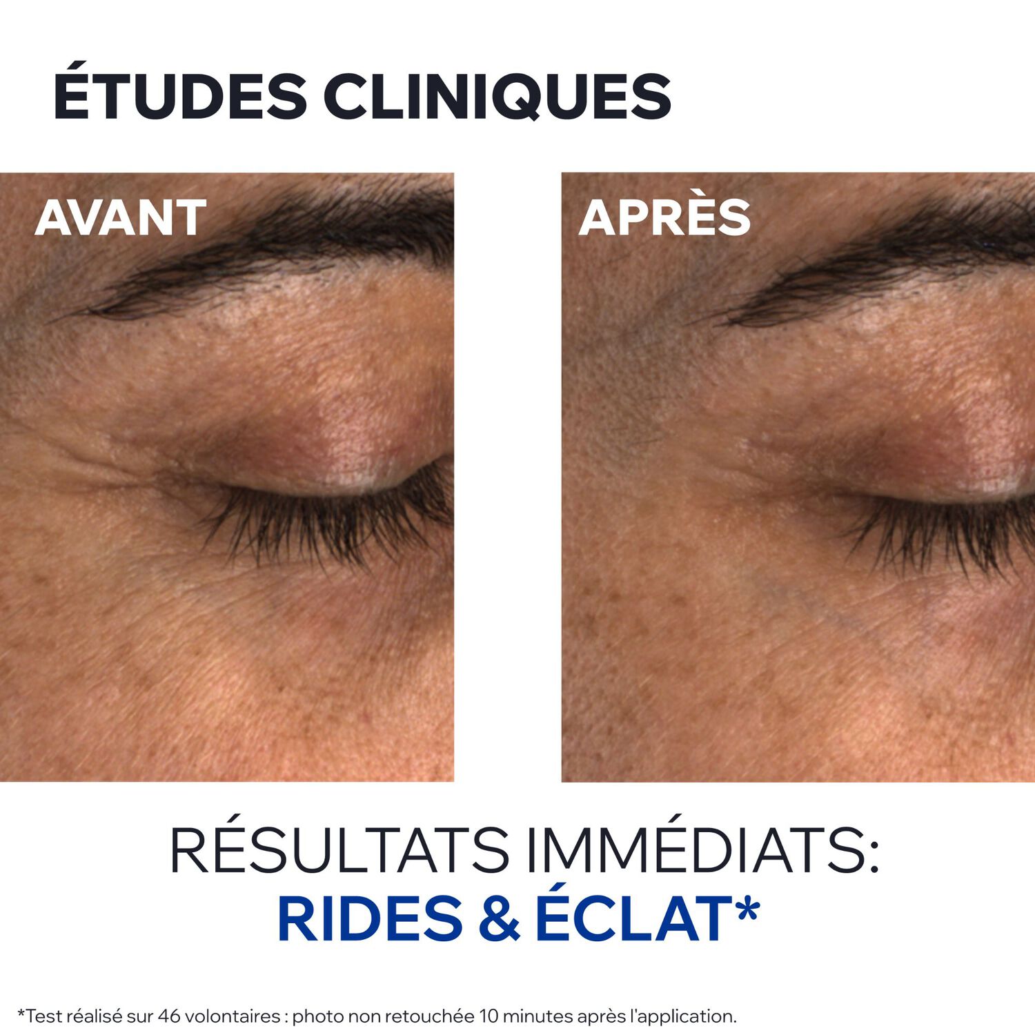 Age Absolu - Baume regard flouteur-redensifiant 15ml