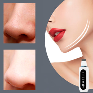 Instrumento de belleza para eliminar puntos negros.