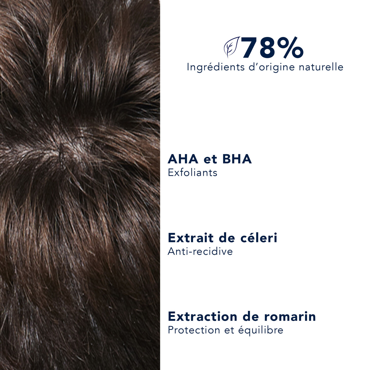 Anti-Pellicules - Shampooing Dermo-Traitant 250 ml