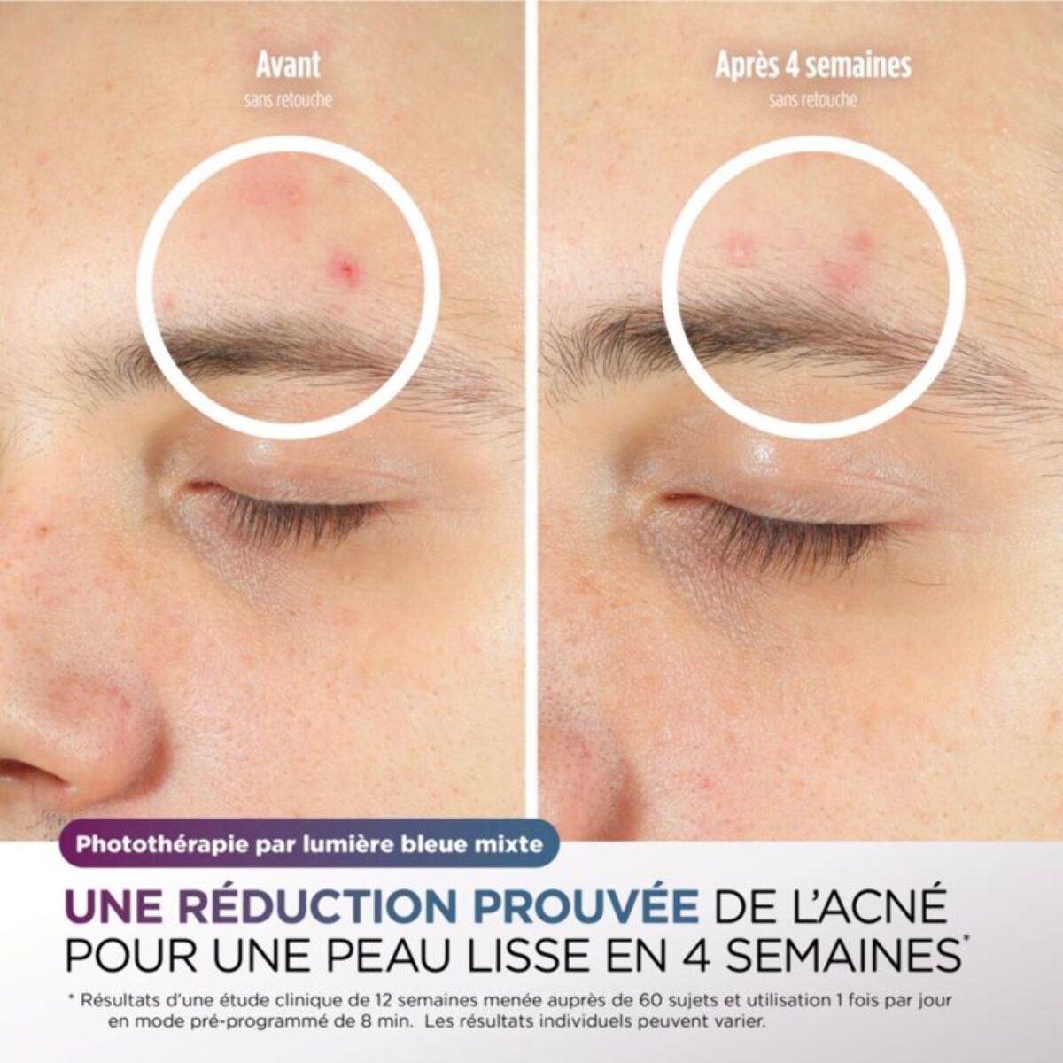 Masque LED SHARK CryoGlow avec rafraîchissement du contour des yeux Lilas