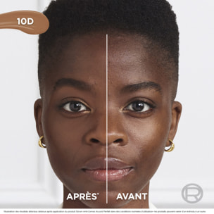 L'Oréal Paris Sérum Anti-Cernes Accord Parfait 10D 11ml