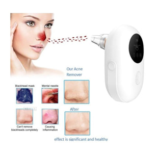 Aspirateur anti points noirs Cenocco CC9098