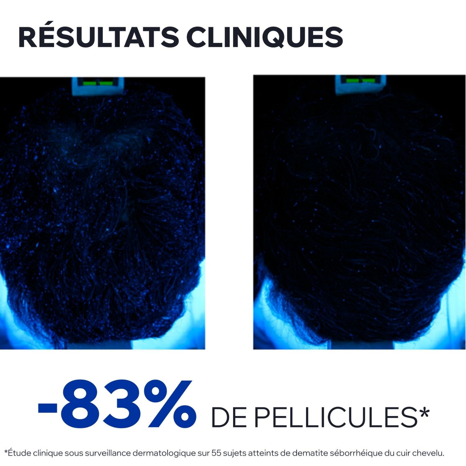 DS Hair - Lotion - Antipelliculaire Régulatrice 100 ml