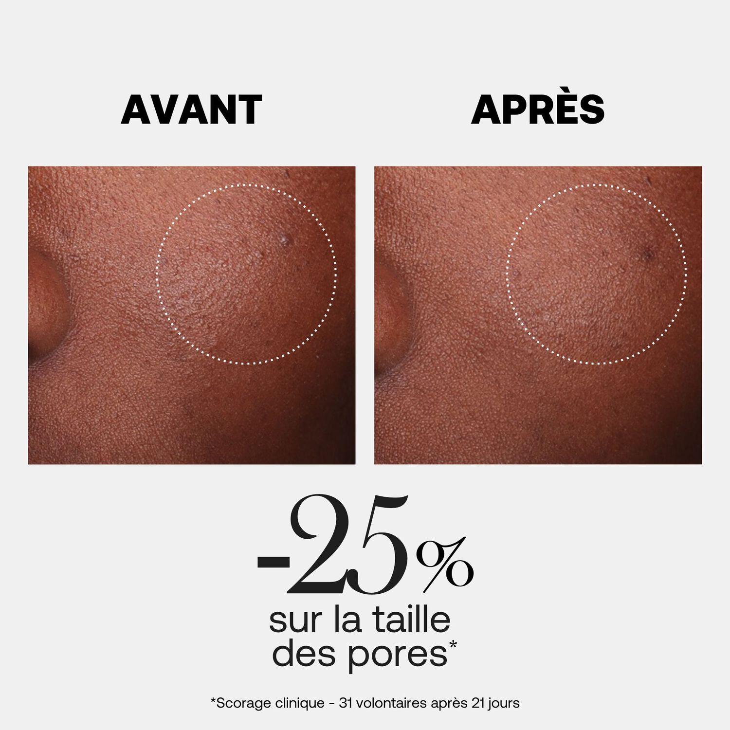 Hyalurx - Lotion Douce Purifiante 150ml