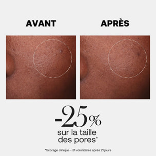 Hyalurx - Lotion Douce Purifiante 150ml