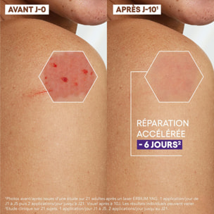 Epitheliale AH ULTRA  - Crème Réparatrice Apaisante