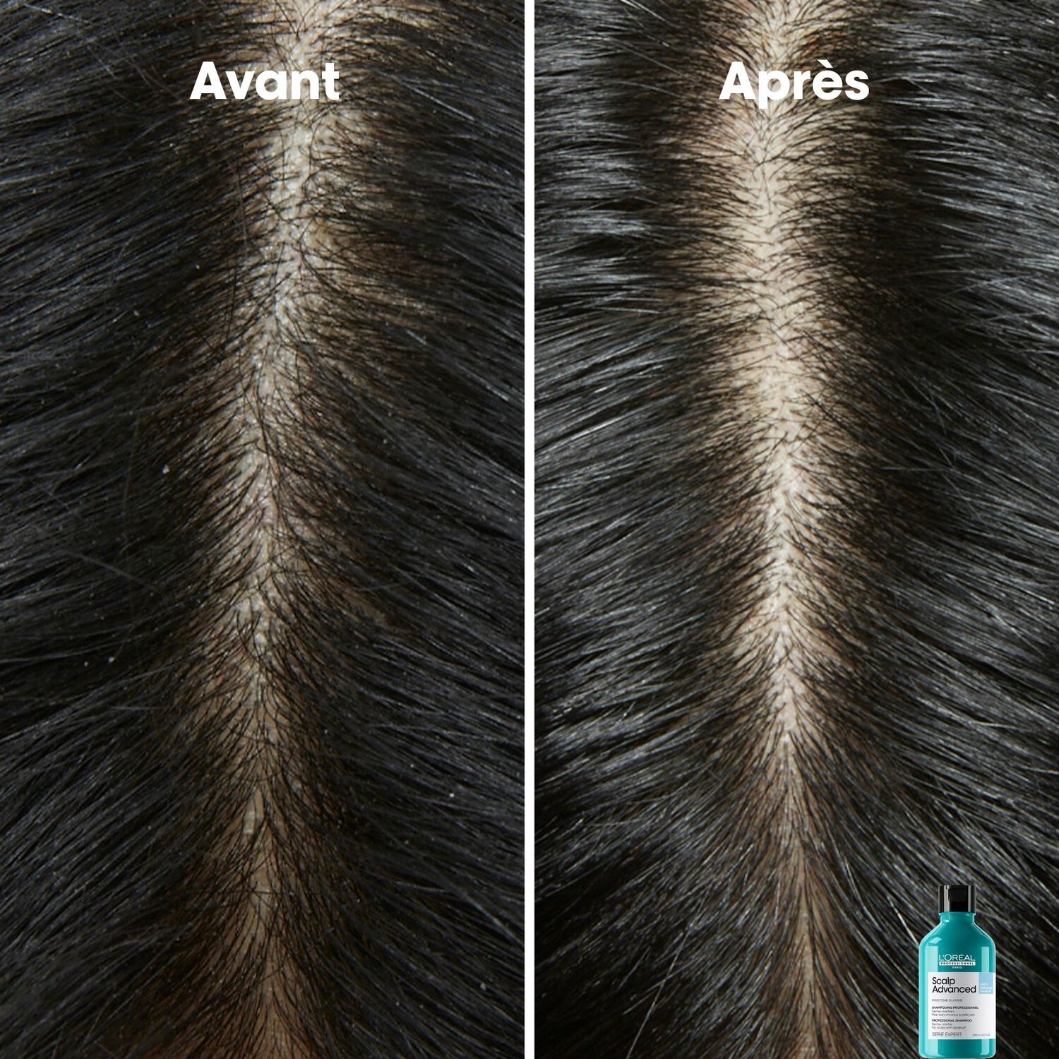Serie Expert Scalp Advanced - Shampooing Dermo-Clarifiant - Cuirs Chevelus à Pellicules 500 ml