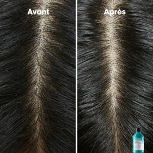 Serie Expert Scalp Advanced - Shampooing Dermo-Clarifiant - Cuirs Chevelus à Pellicules 500 ml