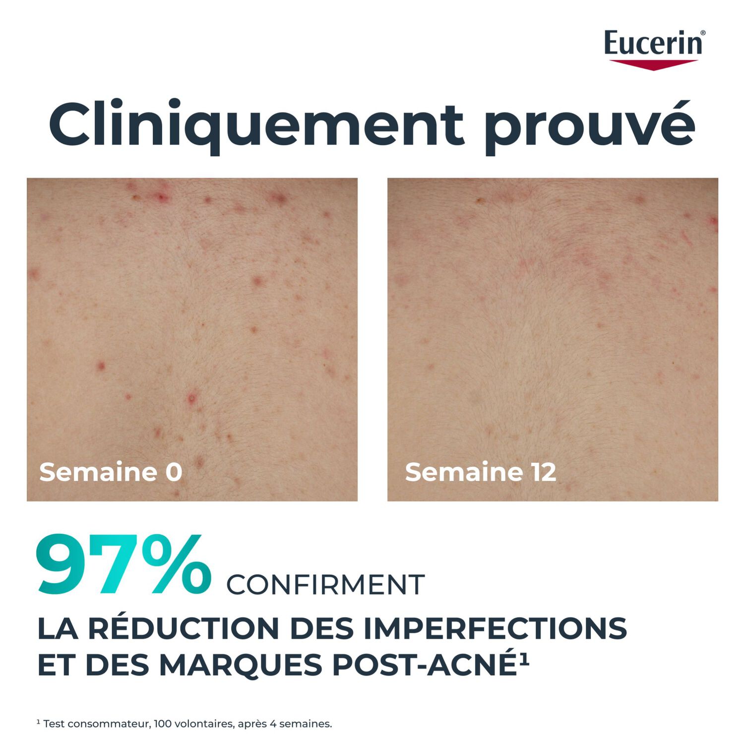 DermoPure Clinical - Crème Corps Correctrice