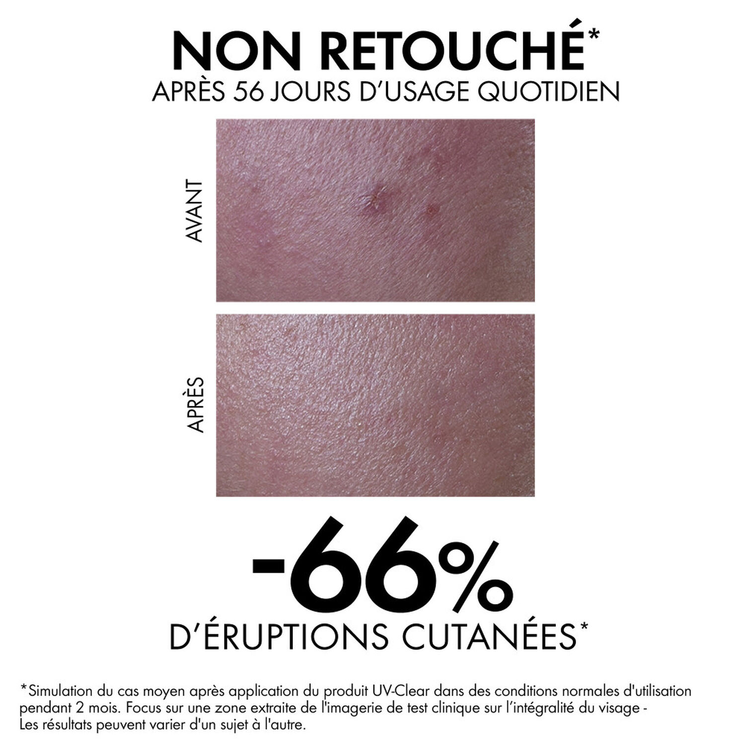 Capital Soleil UV-Clear SPF50+ - Fluide Anti-Imperfections 40 ml