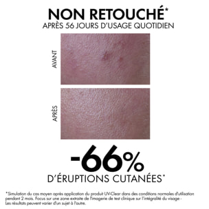 Capital Soleil UV-Clear SPF50+ - Fluide Anti-Imperfections 40 ml