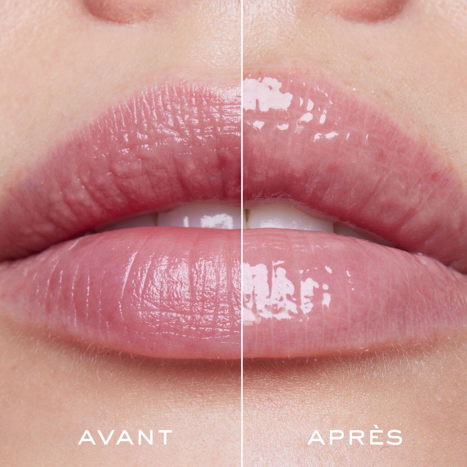 Very Rose - Sérum Lèvres Repulpant avec étui & charms Édition Limitée