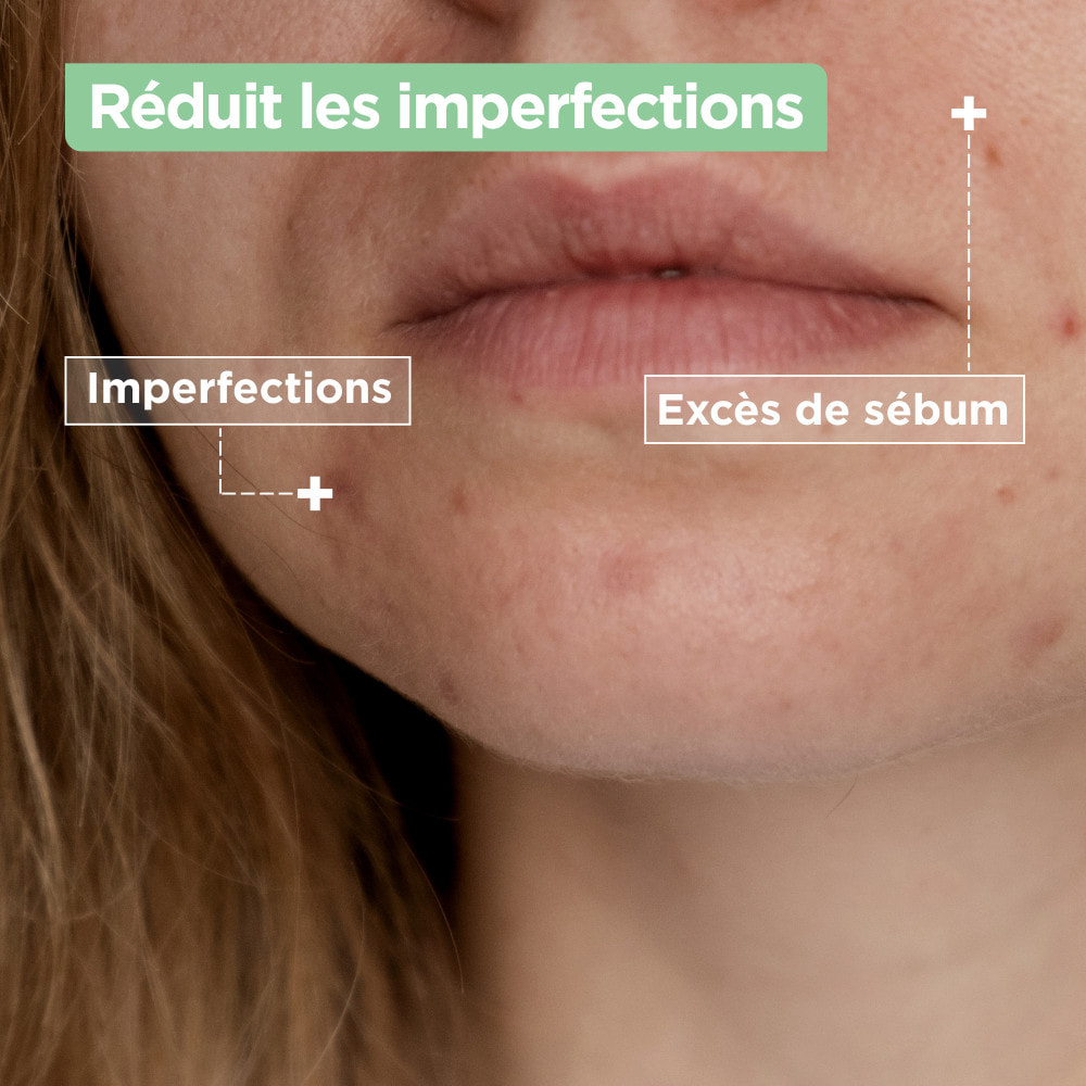 Mixa Lab Nettoyant Confort Anti-imperfections à l’Acide Salicylique 150ml