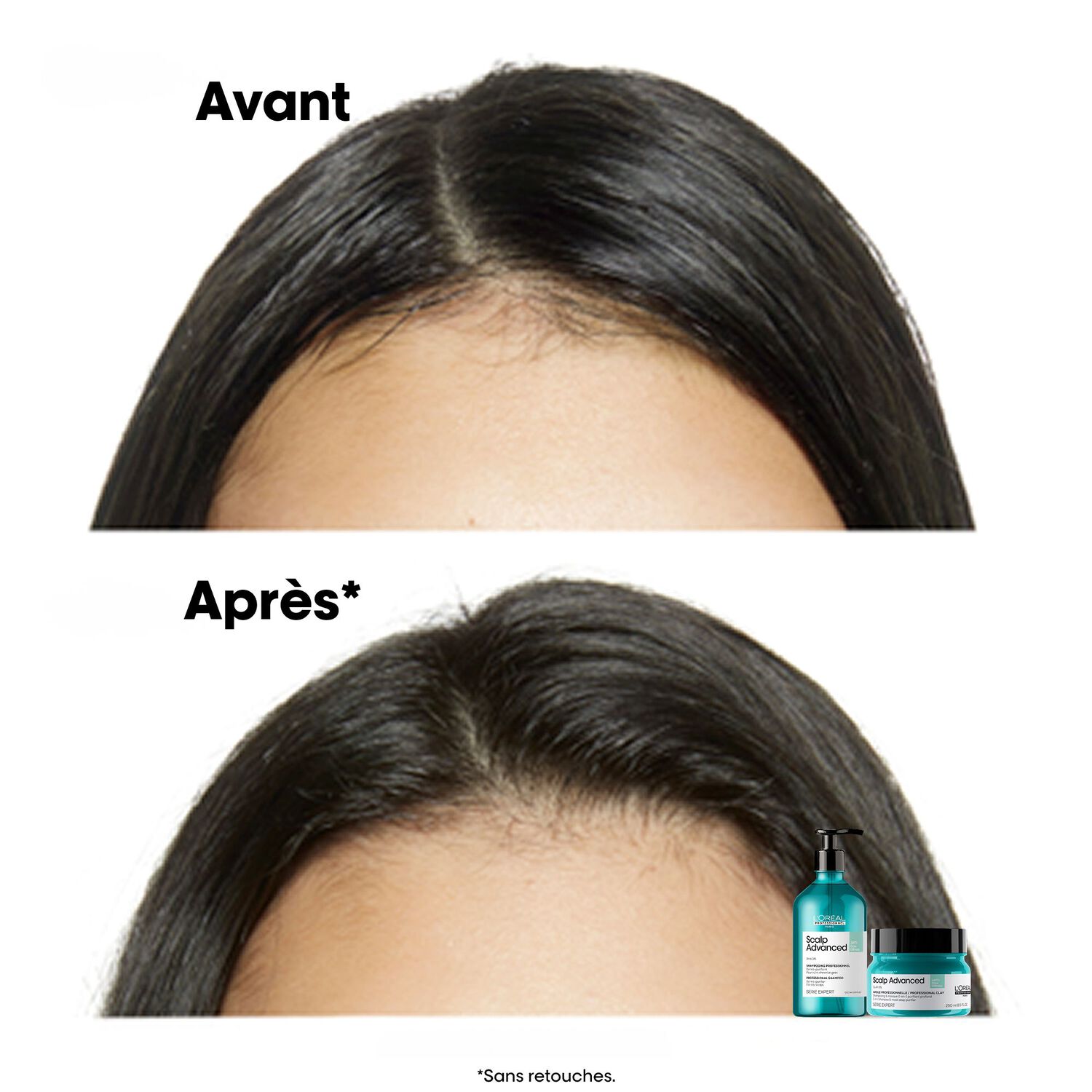 Série Expert Scalp Advanced - Shampooing Dermo-Purifiant - Cuirs Chevelus Gras 500 ml