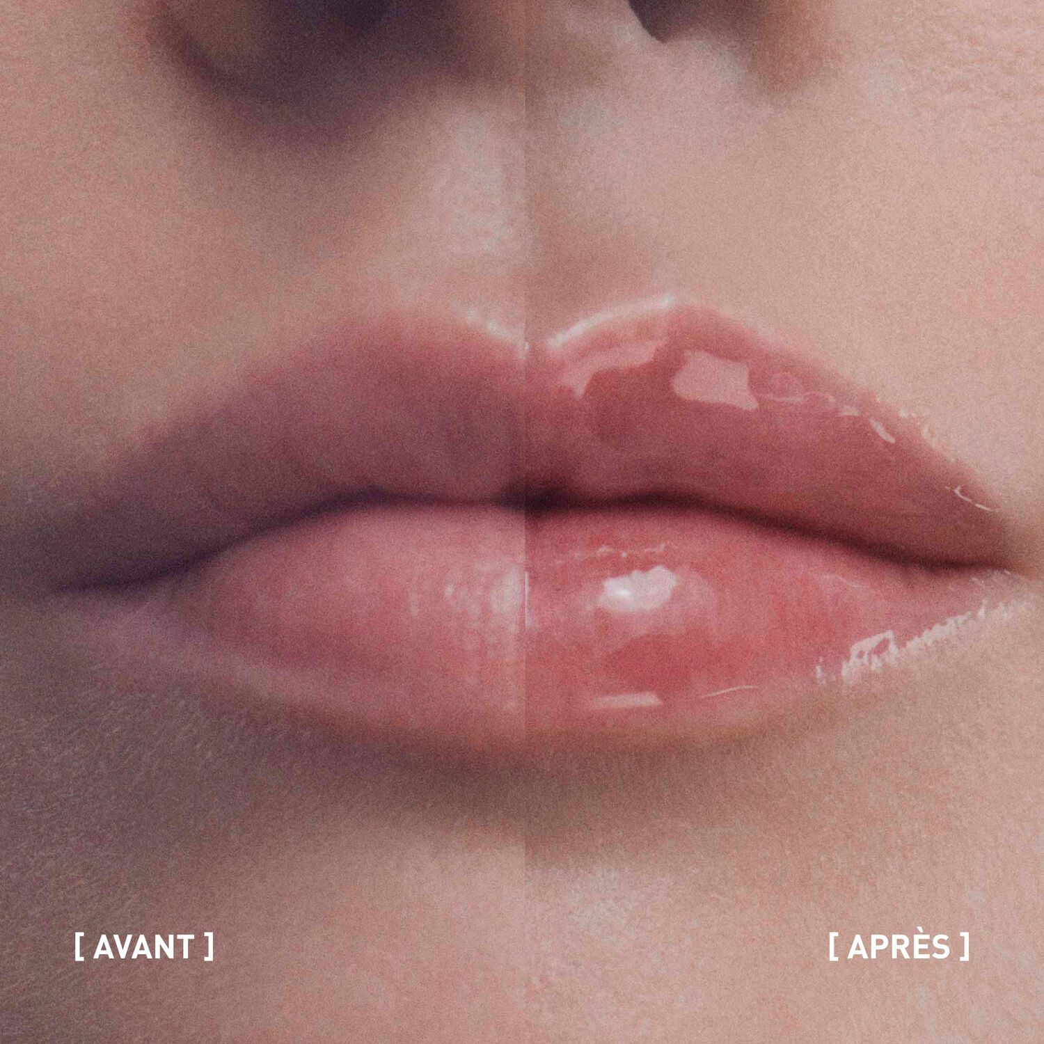 Hyalu-Filler - Soin lèvres volumateur 4g