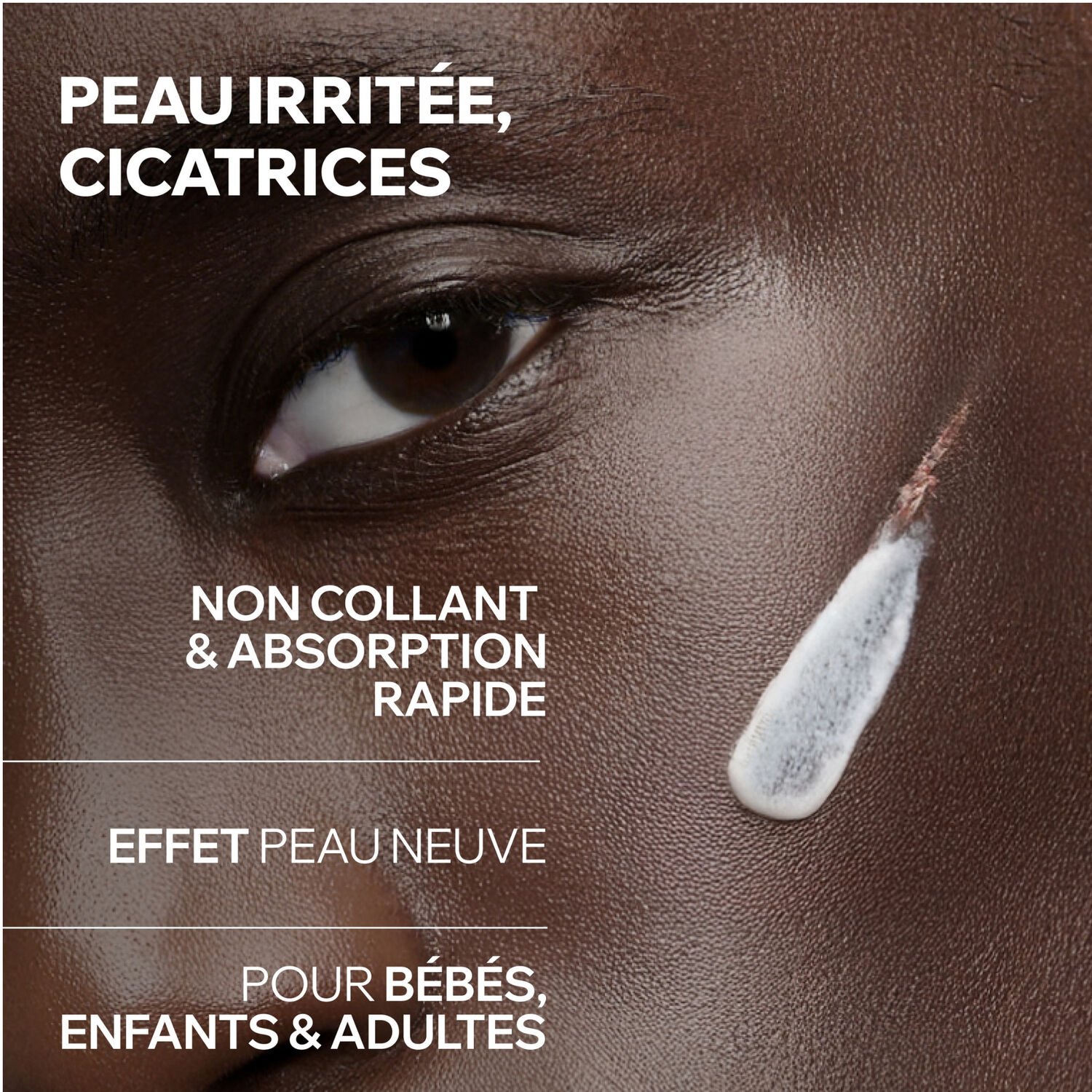 Bariederm Cica+ - Crème Réparatrice Marques Cicatricielles