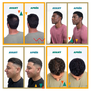 Fibre Capillaire Densifiante - Combles les Zones Clairsemées - Châtain Foncé