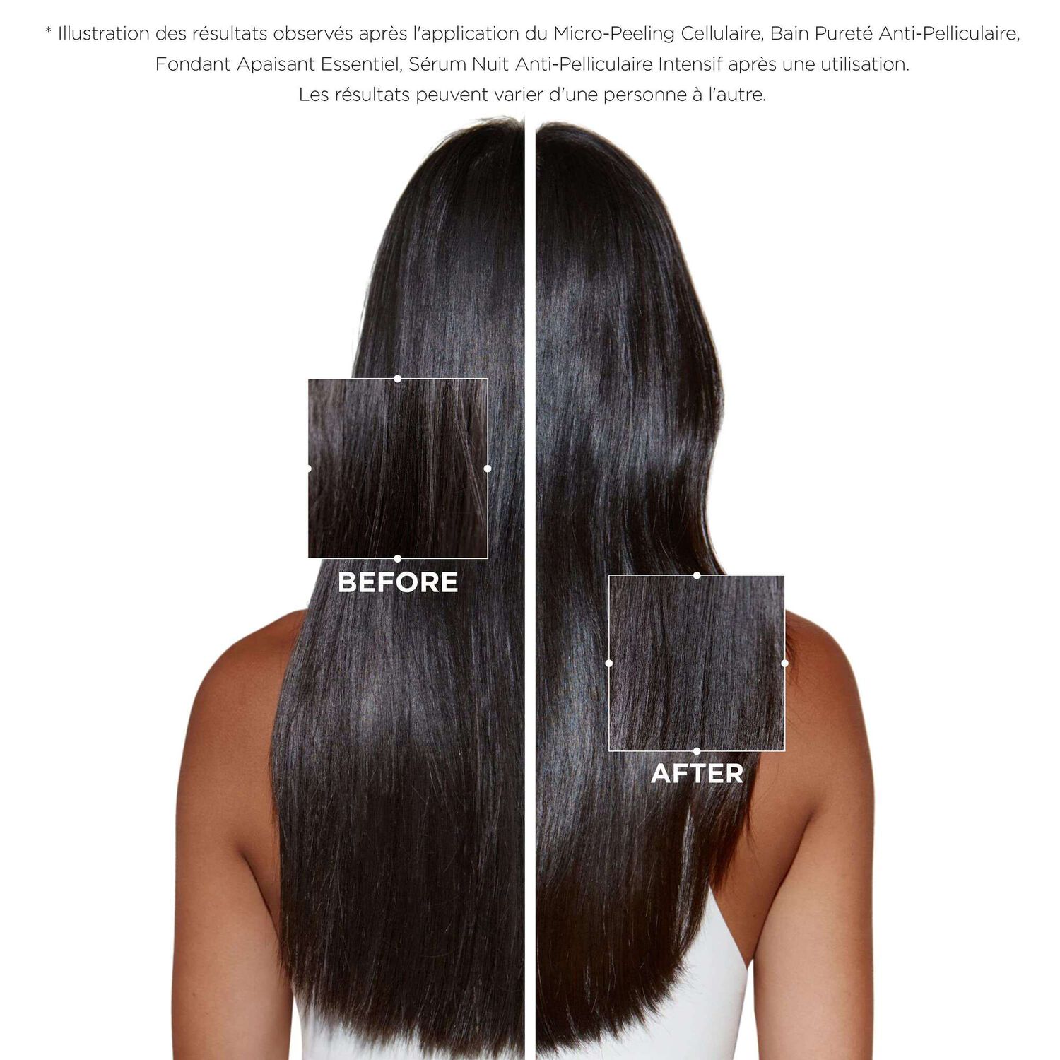Symbiose - Après-shampoing apaisant pour cuir chevelu sensible à tendance pelliculaire 200 ml
