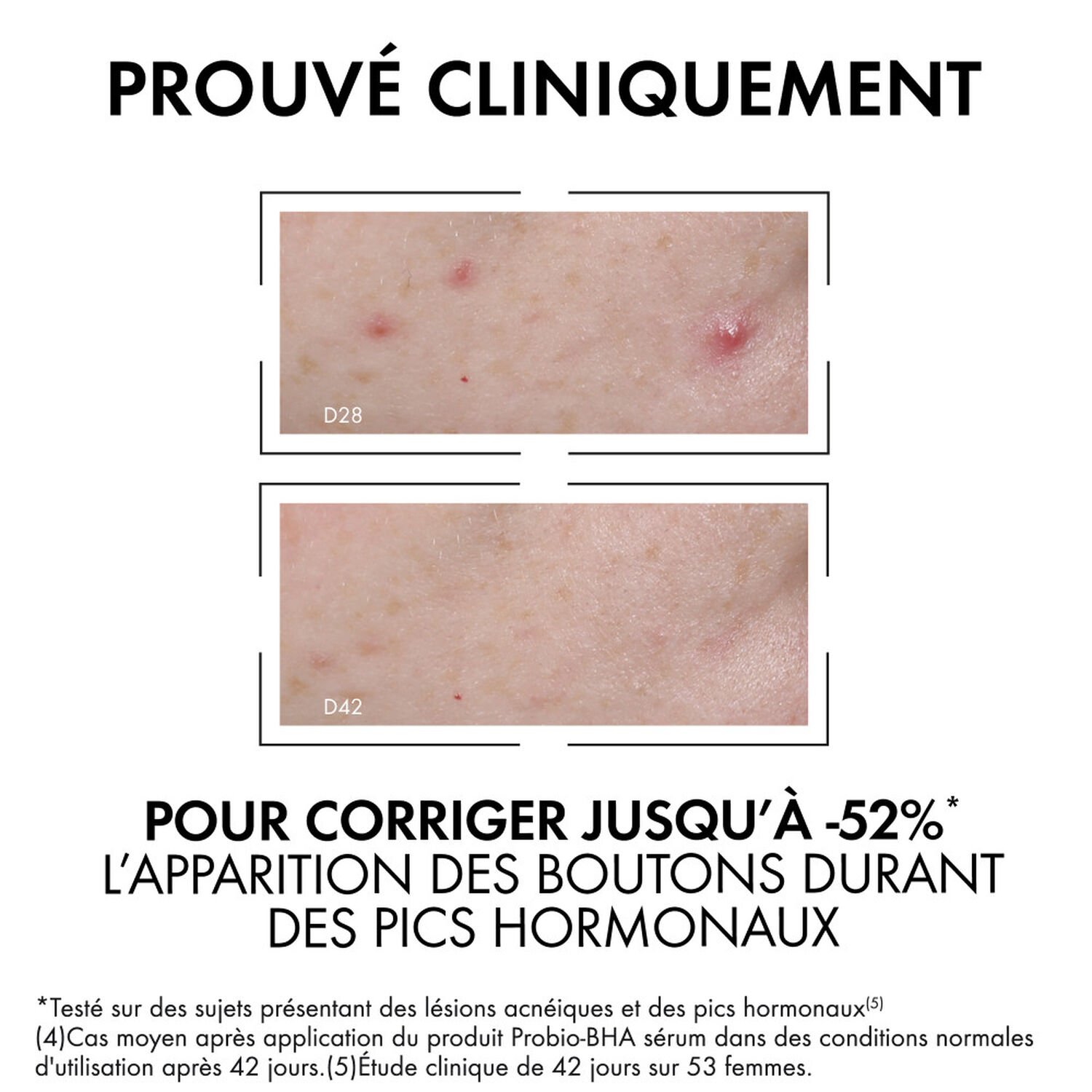 Normaderm - Sérum Anti-Imperfections Probio-Bha - 30 ml