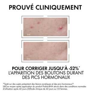 Normaderm - Sérum Anti-Imperfections Probio-Bha - 30 ml