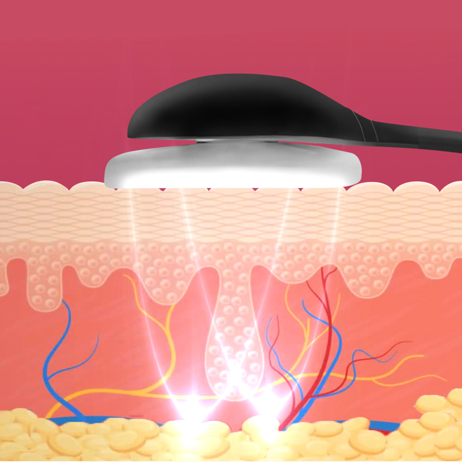 Dispositivo di elettrostimolazione facciale EMS 105D. Effetto rassodante, rimodellante, attenua i segni dell'età.