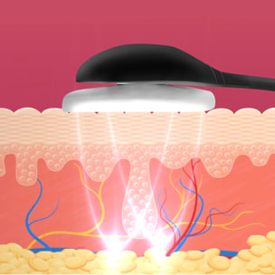 Dispositivo di elettrostimolazione facciale EMS 105D. Effetto rassodante, rimodellante, attenua i segni dell'età.