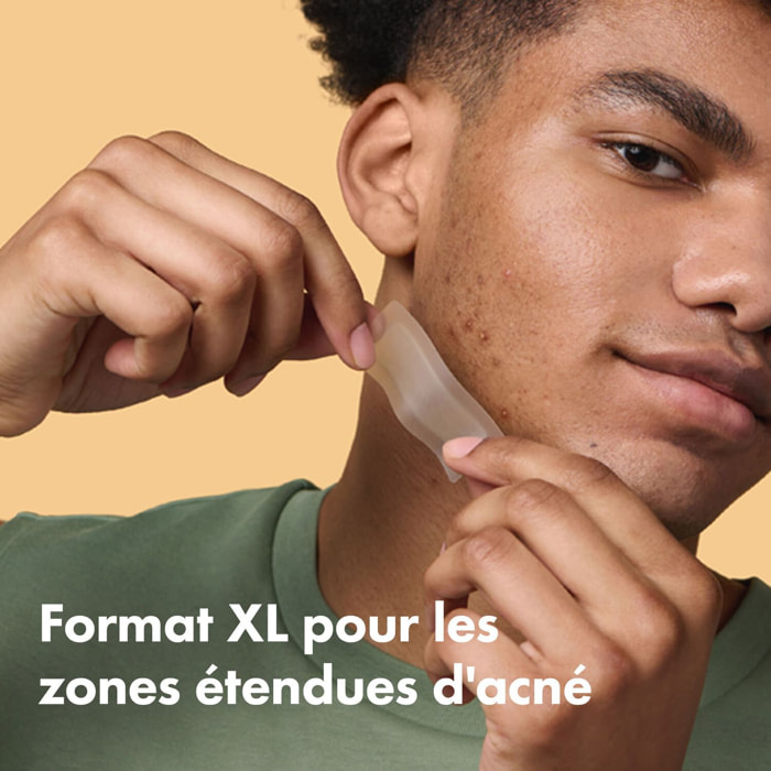 HERO Mighty Patch - Patchs Anti-Acné Surface 10 Patchs