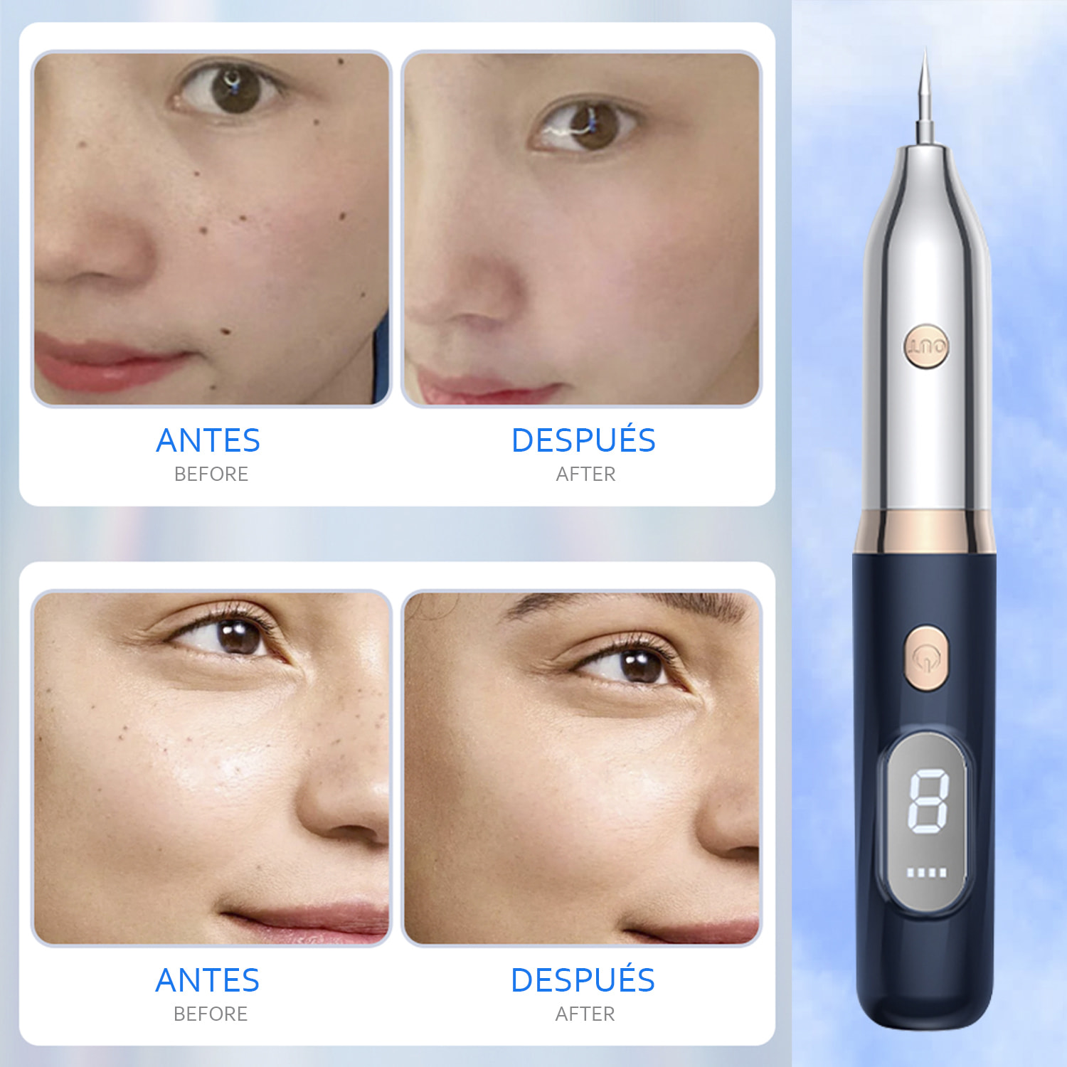 Bolígrafo para nevus. Para pecas, placas seniles, nevos planos, etc.